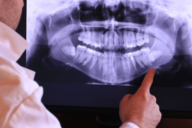 Best Emergency Denture Repair in Richwood, WV