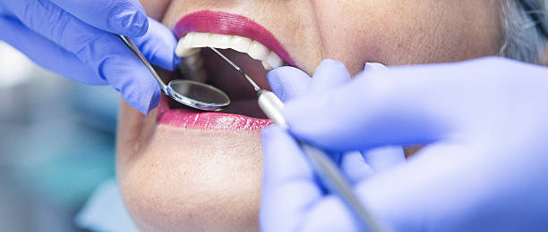 Best Emergency Wisdom Tooth Extraction in Richwood, WV